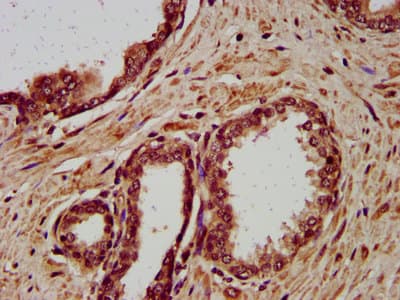 DSC3 / Desmocollin 3 Antibody