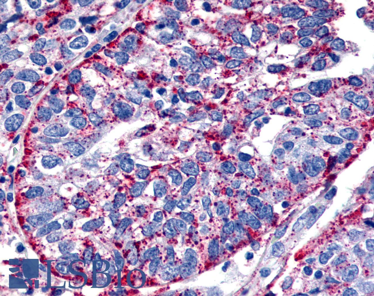 PathPlus™ Polyclonal Rabbit anti-Human ADGRE3 / EMR3 Antibody (N-Terminus, IHC)