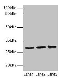 CA1 / Carbonic Anhydrase I Antibody