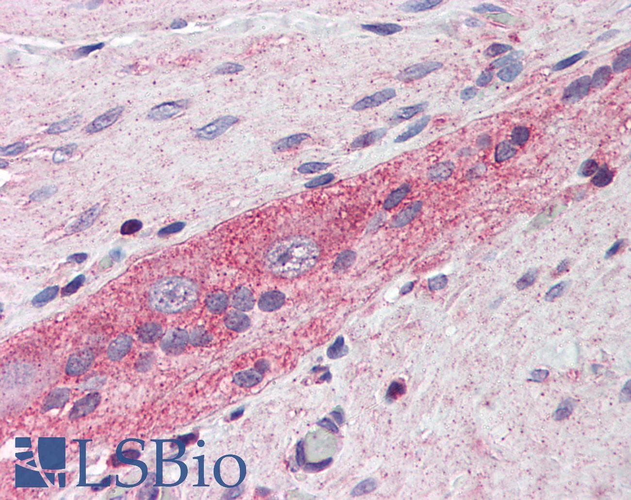 IHC-plus™ Monoclonal Mouse anti-Human RHOA Antibody (clone 1B12, IHC, IF, WB)