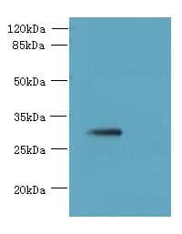 SLC25A4 / ANT Antibody