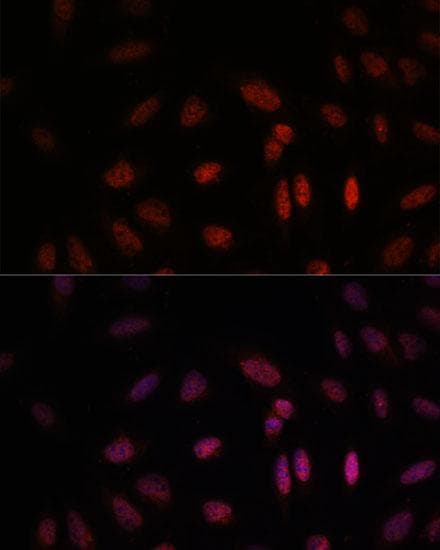 Polyclonal Rabbit anti-Human WDR18 Antibody (IF)
