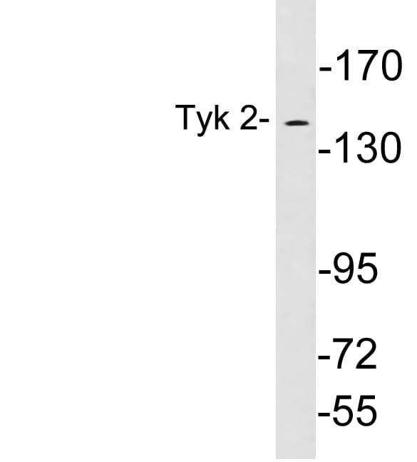 TYK2 Antibody (aa250-299)