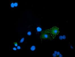 Monoclonal Mouse anti-Human BIN3 Antibody (clone OTI2D7, IF, WB)