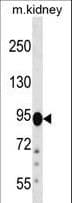 Polyclonal Rabbit anti-Human FIG4 Antibody (aa846-874, WB)