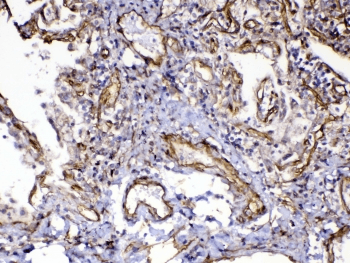 FLT4 / VEGFR3 Antibody