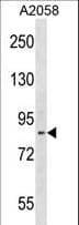 Polyclonal Rabbit anti-Human ADAM23 Antibody (aa803-831, WB)