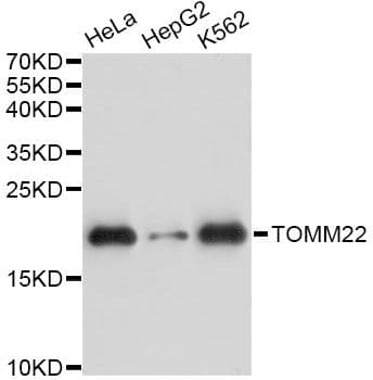 TOMM22 / TOM22 Antibody