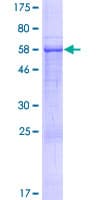 Human CACUL1 / Cullin Protein (Recombinant GST)