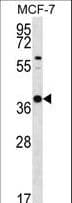 Polyclonal Rabbit anti-Human YIF1B Antibody (aa82-110, IHC, WB)