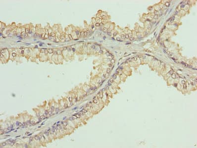 KDM5A / JARID1A Antibody