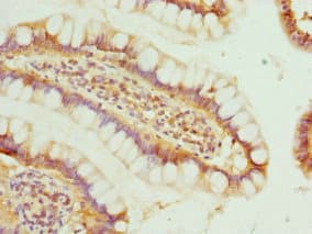 Polyclonal Rabbit anti-Human BTG1 Antibody (IHC)