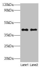Polyclonal Rabbit anti-Human QPCT / QC Antibody (WB)