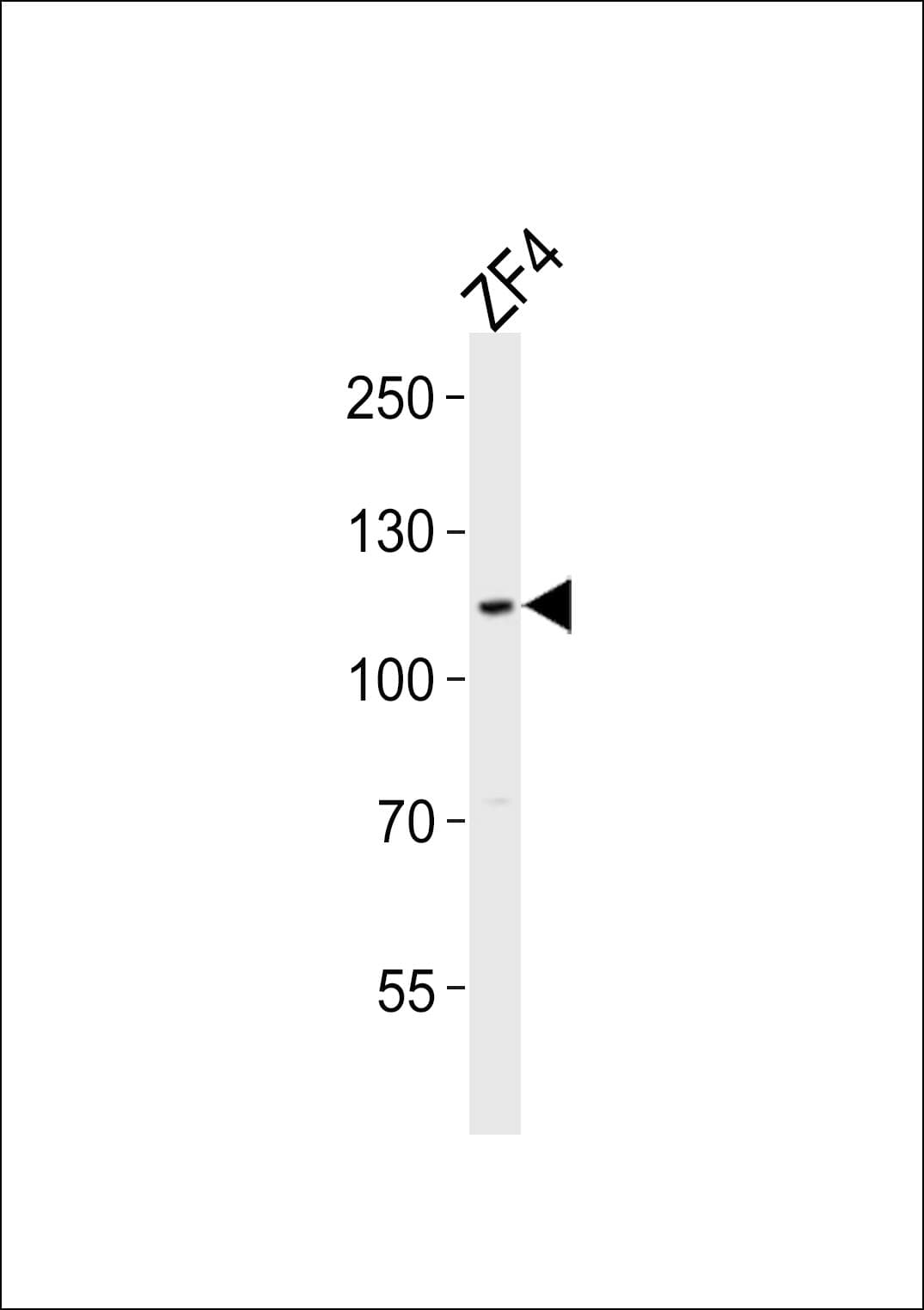 Polyclonal Rabbit anti-Zebrafish SH3BP4 Antibody (aa132-165, WB)