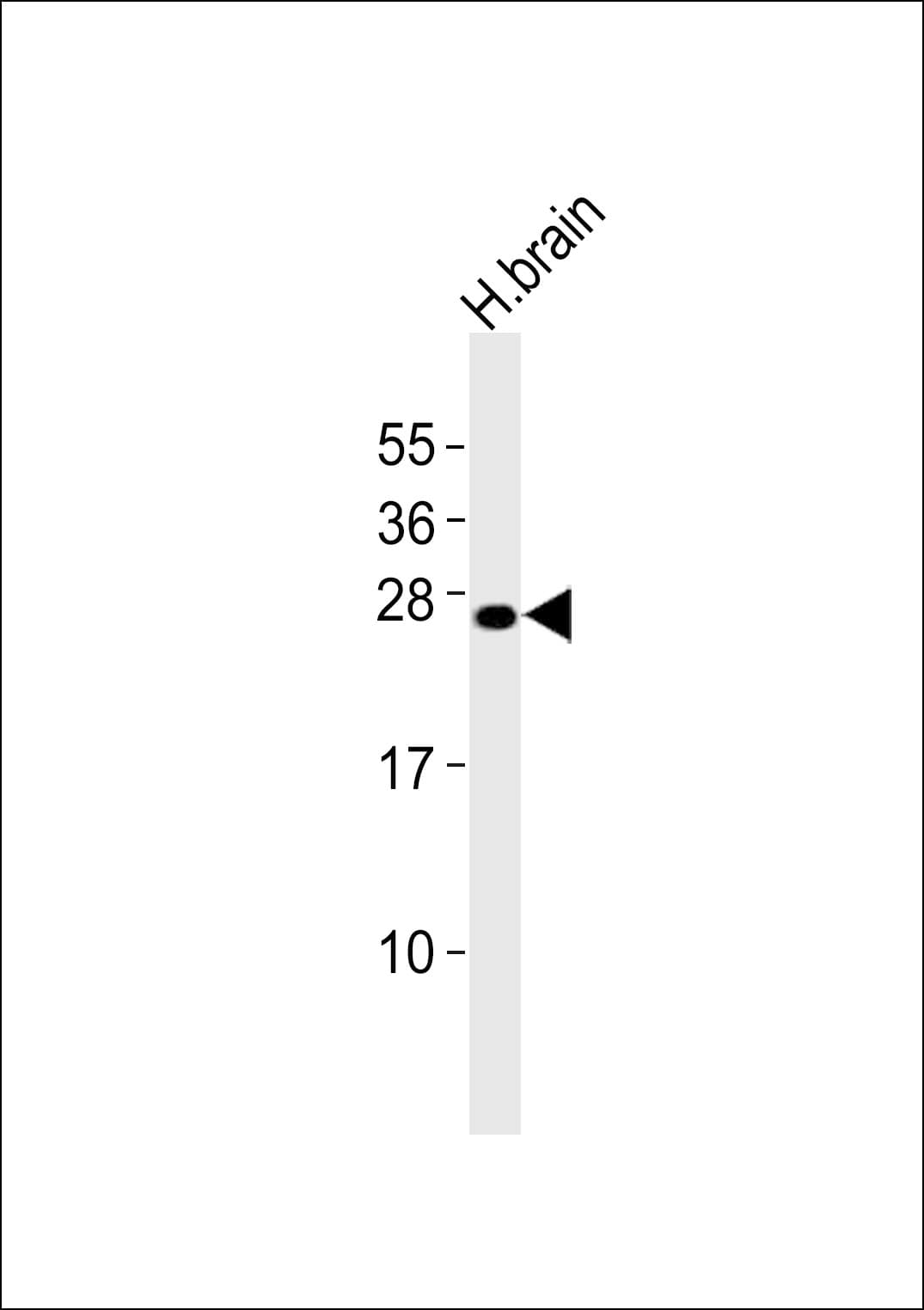 FGF14 Antibody (aa175-209)