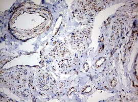 NDUFS2 Antibody (aa205-463, clone OTI1D5, Carrier-free)