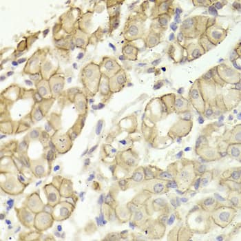 CTNND1 / p120 Catenin Antibody