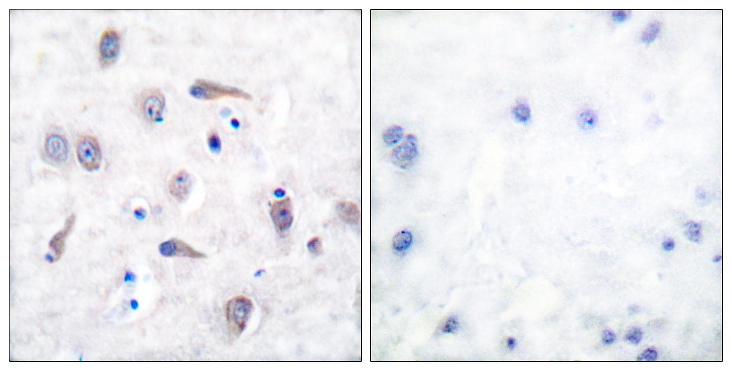 APP / Beta Amyloid Precursor Antibody (p743/668)