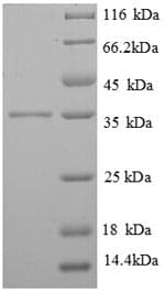 Human FCER1G Protein (Recombinant GST, N-terminus)
