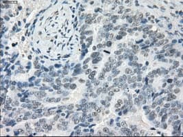 LTA4H / LTA4 Antibody (clone OTI2C5)