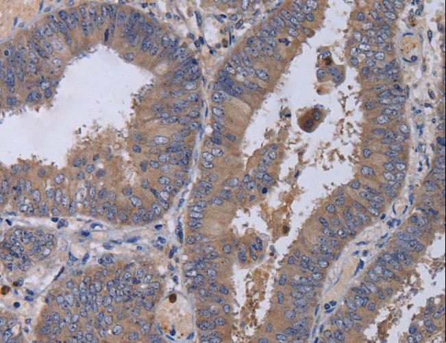Polyclonal Rabbit anti-Human MKKS Antibody (IHC)