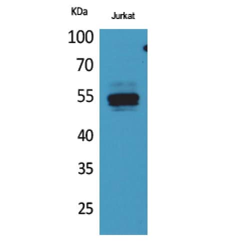 Polyclonal Rabbit anti-Human DPP2 / DPP7 Antibody (C-terminal, WB)