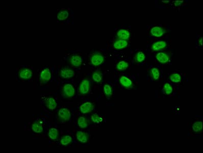 Polyclonal Rabbit anti-Human HIST1H2BN Antibody (IHC, IF, WB)