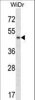 Polyclonal Rabbit anti-Human ANKS4B Antibody (aa184-213, WB)