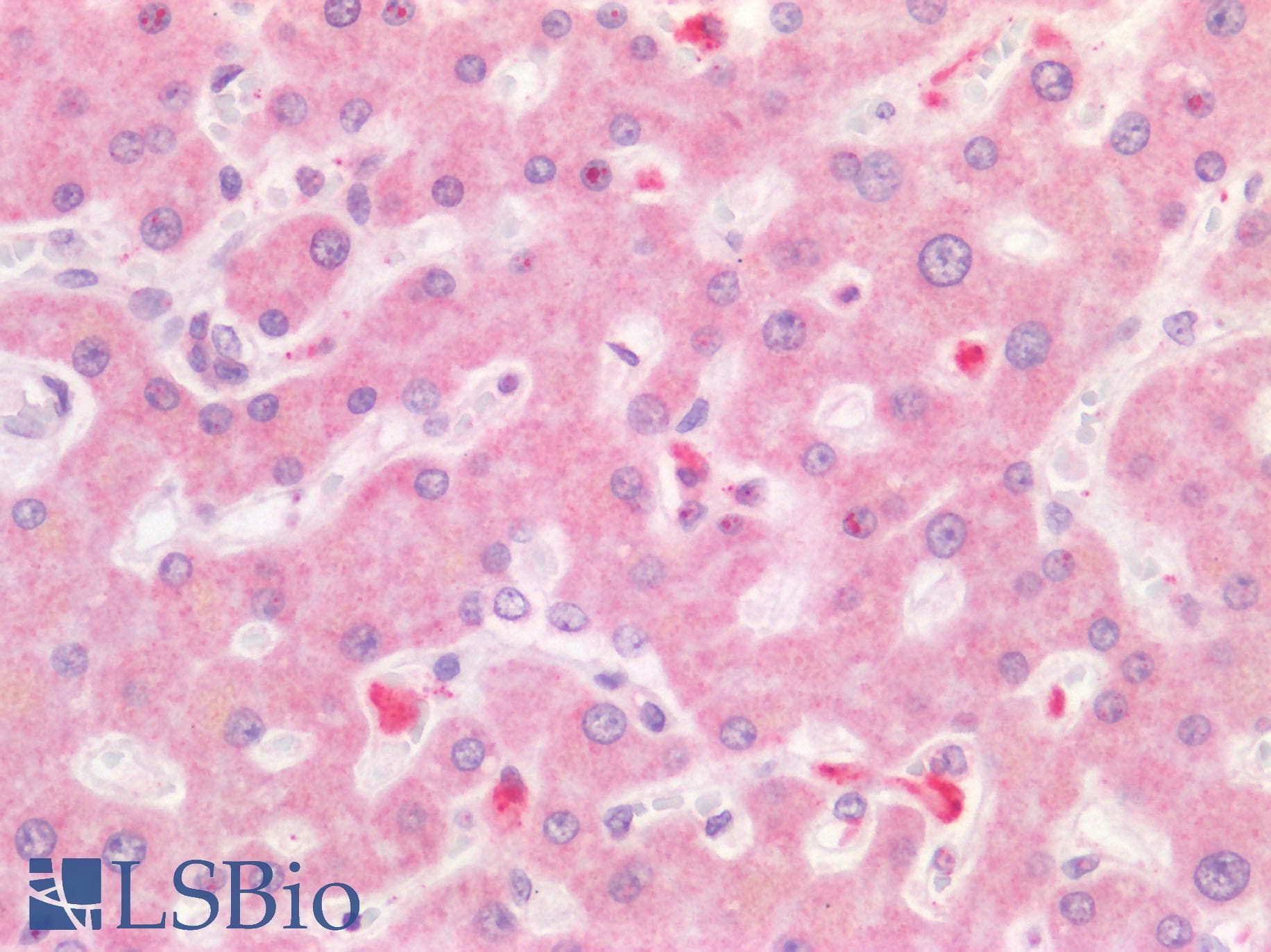IHC-plus™ Polyclonal Rabbit anti-Human HPSE / Heparanase Antibody (IHC, WB)