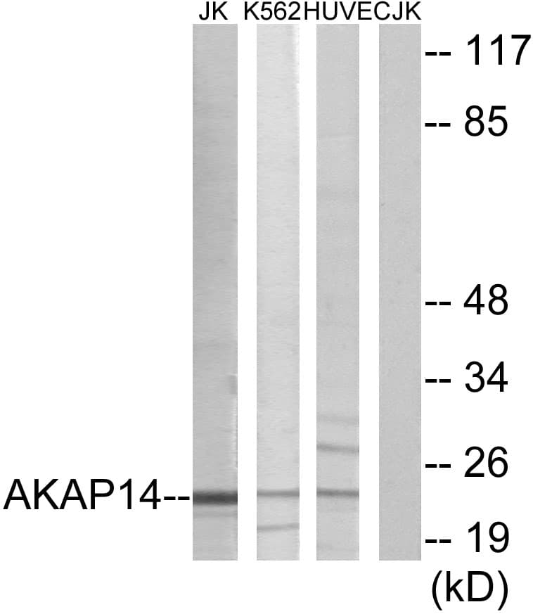 AKAP14 Antibody (aa1-50)