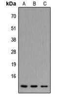 ATP5J2 / F1Fo-ATPase Antibody (C-Terminus)