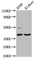 LGALS12 / Galectin 12 Antibody