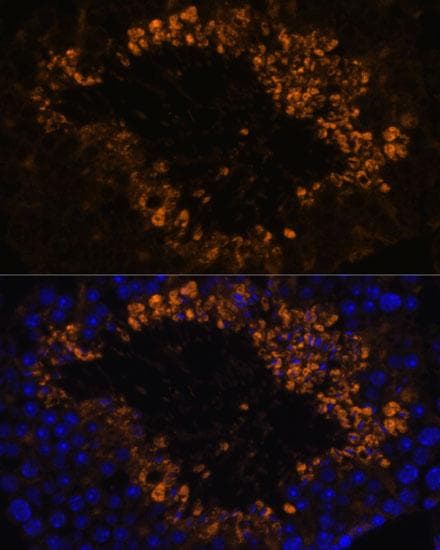 OXCT2 Antibody