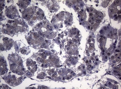 Monoclonal Mouse anti-Human SF1 Antibody (clone OTI7H9, aa1-276, IHC, WB)