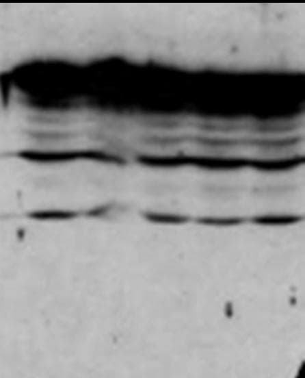 CDK1 / CDC2 Antibody (C-Terminus)