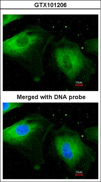 FLNB / TAP Antibody