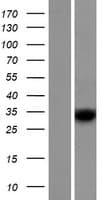 RDH8 Protein (Over-Expression Lysate Myc-DDK (Flag))