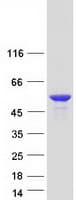 Human CCDC17 Protein (Recombinant Myc-DDK (Flag))