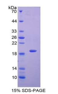 Mouse LGALS7 / Galectin 7 Protein (Recombinant His-T7)