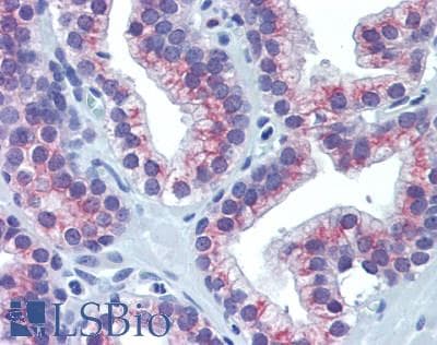 IHC-plus™ Polyclonal Rabbit anti-Human GOLGA2 / GM130 Antibody (aa20-300, IHC)