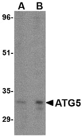 APG5 / ATG5 Antibody