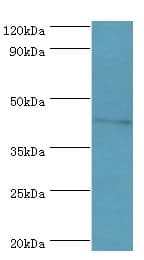 Polyclonal Rabbit anti-Human DRD3 / Dopamine Receptor D3 Antibody (aa213-329, IHC, WB)