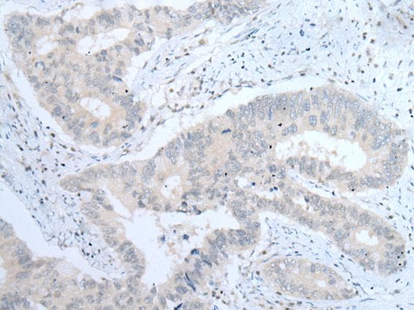 ITGA8 / Integrin Alpha 8 Antibody