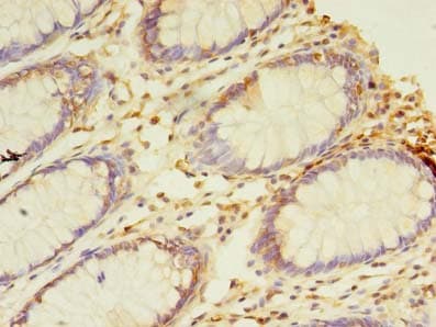 Polyclonal Rabbit anti-Human NAIF1 Antibody (IHC, WB)