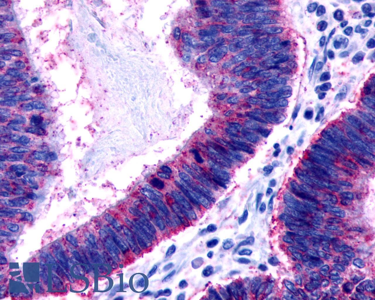 IHC-plus™ Polyclonal Rabbit anti-Human F2RL2 / PAR3 Antibody (C-Terminus, IHC)