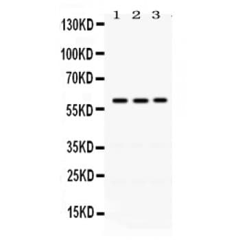 Polyclonal Rabbit anti-Human RAG2 / RAG-2 Antibody (aa498-527, IHC, WB)