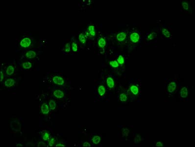 DACT1 / DAPPER Antibody