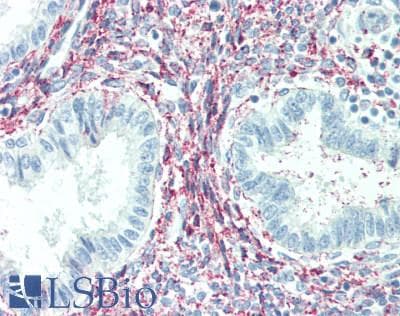 FGF23 Antibody (aa24-126)