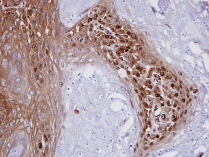 WBSCR22 Antibody (aa1-263)