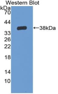 IL6R / IL6 Receptor Antibody (aa19-348, Cy3)